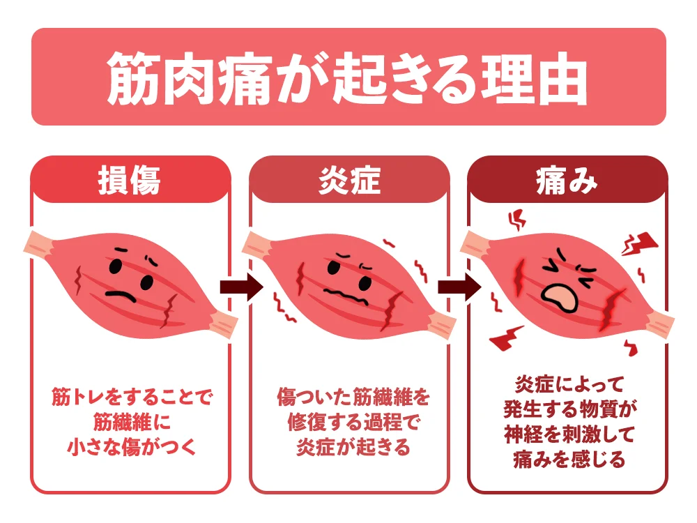 「そもそも「筋肉痛」ってなぜ起こるの？」の画像